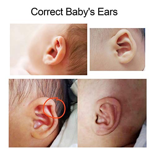 Buy now ZJchao Baby Auricle Valgus Correction Patch, Newborn Baby Ear Aesthetic Correctors Kids Infant Protruding Ear Patch Stickers, Children Ear Correction, Baby Silicone Gel Ear Tape 4cmx50cm at indiglob india