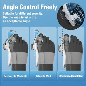Tech Love Bunion Corrector for Women and Men Big Toe, Orthopedic Bunion Toe Straightener, Adjustable Bunion Splint with Toe Separator for Bunion Relief, Day Night Support