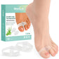 Welnove Pack of 12 Bunion Corrector, Toe Separators with 2 Loops, Big Toe Spacer Suitable for Bunion and Overlap Toe (White)