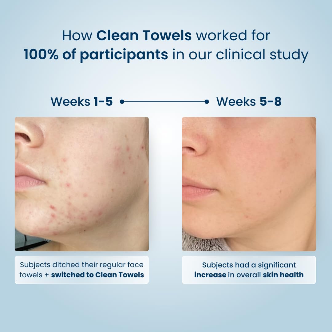 Buy now Clean Skin Club Clean Towels®, 100% USDA Biobased Face Towel, Disposable Face Towelette, Eczema Association Accepted, Makeup Remover Dry Wipes, Ultra Soft, 1 Pack, 25 Ct at indiglob india