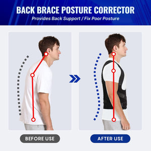 Posture Corrector for Women and Men, Adjustable Back Brace & Straightener for Scoliosis - Hunchback Correction - Back Pain/Spine Corrector/Back Support and Posture Trainer (Small)
