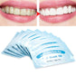 Mint-Flavored Oral Finger Wipes Teeth whitening Wipes Oral Cleaning Wipe (100 Pcs)