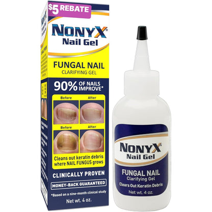 NONYX Fungal Nail Clarifying Gel | Clinically Proven for Discolored, Thick, Brittle, Yellow, Lifted, and other signs of Fungus-Damaged Toenails | 90% of Nails Improve | Over 8 million sold