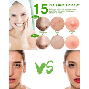 15 PCS Blackhead Remover Pimple Popper Tool Kit,Black Head Removal Extractor for Acne Comedone Whitehead Popping Zit Blemish Facial Skin Care Tools with Metal Case