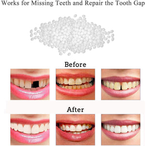 Tooth Repair Kit-Thermal Beads for Filling Fix The Missing and Broken Tooth or Adhesive The Denture Fake Teeth