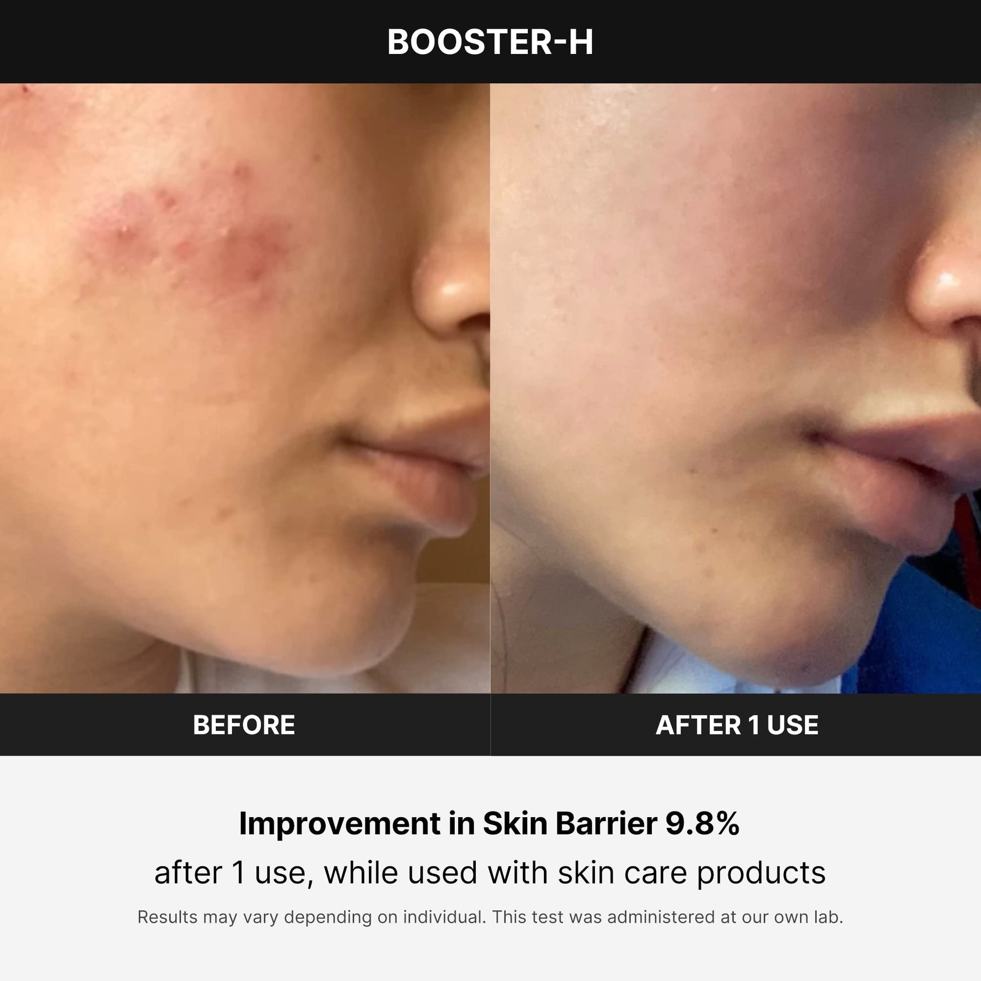 Buy now medicube Booster H - Korean Skincare Tool - Facial Glow Booster for Maximizing and Boosting Skin Care Absorption - Needle Free at indiglob india