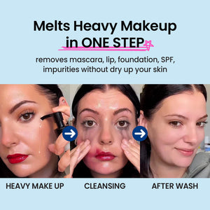 coxir ULTRA HYALURONIC CLEANSING OIL | Korean Facial Cleansing Oil for Blackheads, Makeup & Sebum | Multi-Layer Hyaluronic Acid, Vegan & Non-Comedogenic Cleanser | 5.07 fl.oz