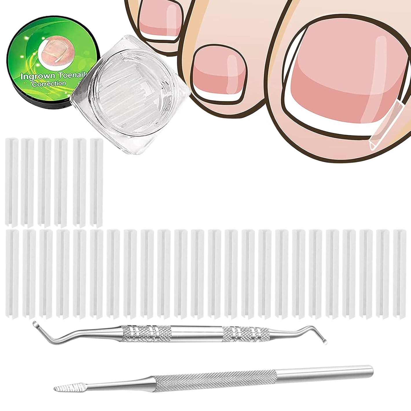 (30+2) Pack Ingrown Toenail Correction Treatment Kit, 30PCS Ingrown Toenails Corrector Strips Brace Ingrown Toenail Pedicure Tool Toenail Correction Patch with 2PCS Ingrown Toenails Lifter and File