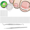 (30+2) Pack Ingrown Toenail Correction Treatment Kit, 30PCS Ingrown Toenails Corrector Strips Brace Ingrown Toenail Pedicure Tool Toenail Correction Patch with 2PCS Ingrown Toenails Lifter and File - silver-32pcs