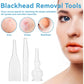 3pcs Vacuum Glass Tube Kit, Blackhead Removal Facial Suction Pore Vacuum Cleaner for Face Cleanser Blackhead Removal Machine Microdermabrasion Machine Accessories