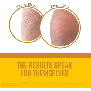 O'Keeffe's Skin Repair Body Lotion, 12 Oz