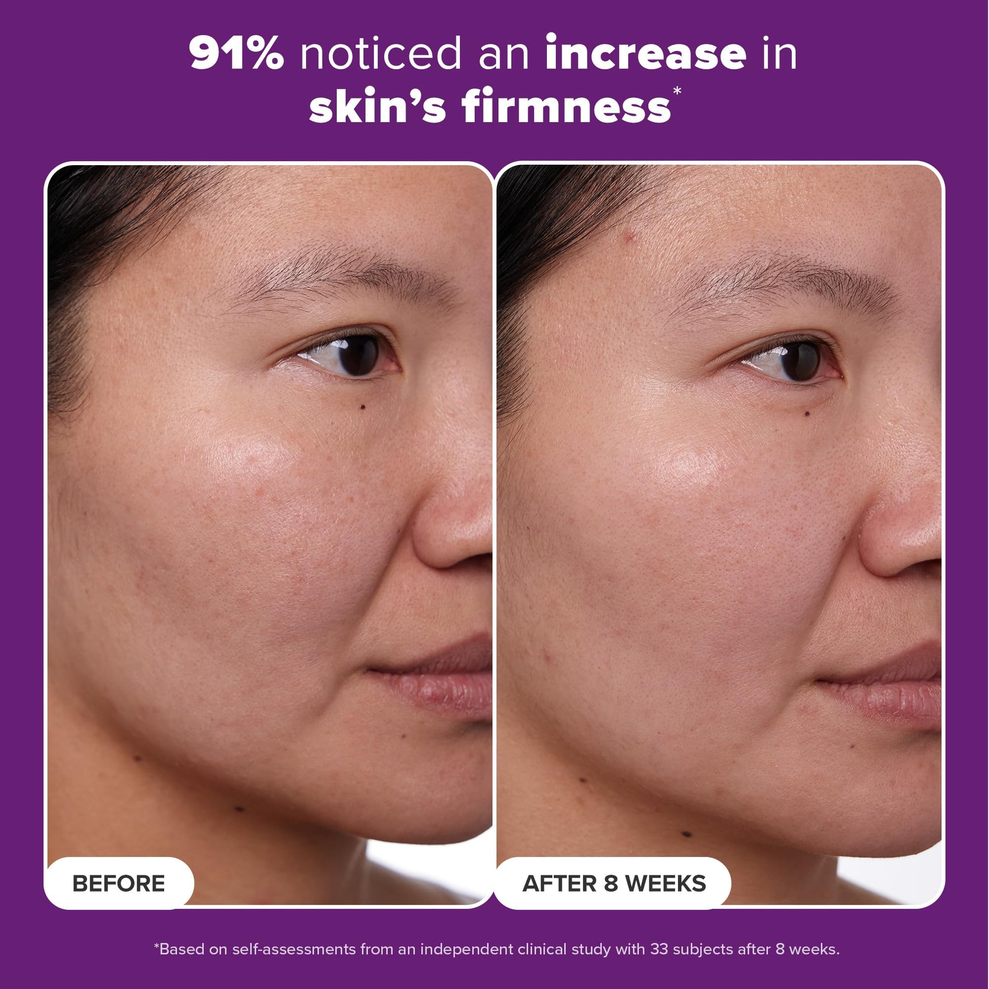 Buy now Paula's Choice CLINICAL 1% Retinol Face Treatment with Peptides, Vitamin C & Licorice Extract, Anti-Aging Skin Care Serum, Fine Lines & Wrinkles, Fragrance Free at indiglob india