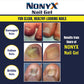 NONYX Fungal Nail Clarifying Gel | Clinically Proven for Discolored, Thick, Brittle, Yellow, Lifted, and other signs of Fungus-Damaged Toenails | 90% of Nails Improve | Over 8 million sold