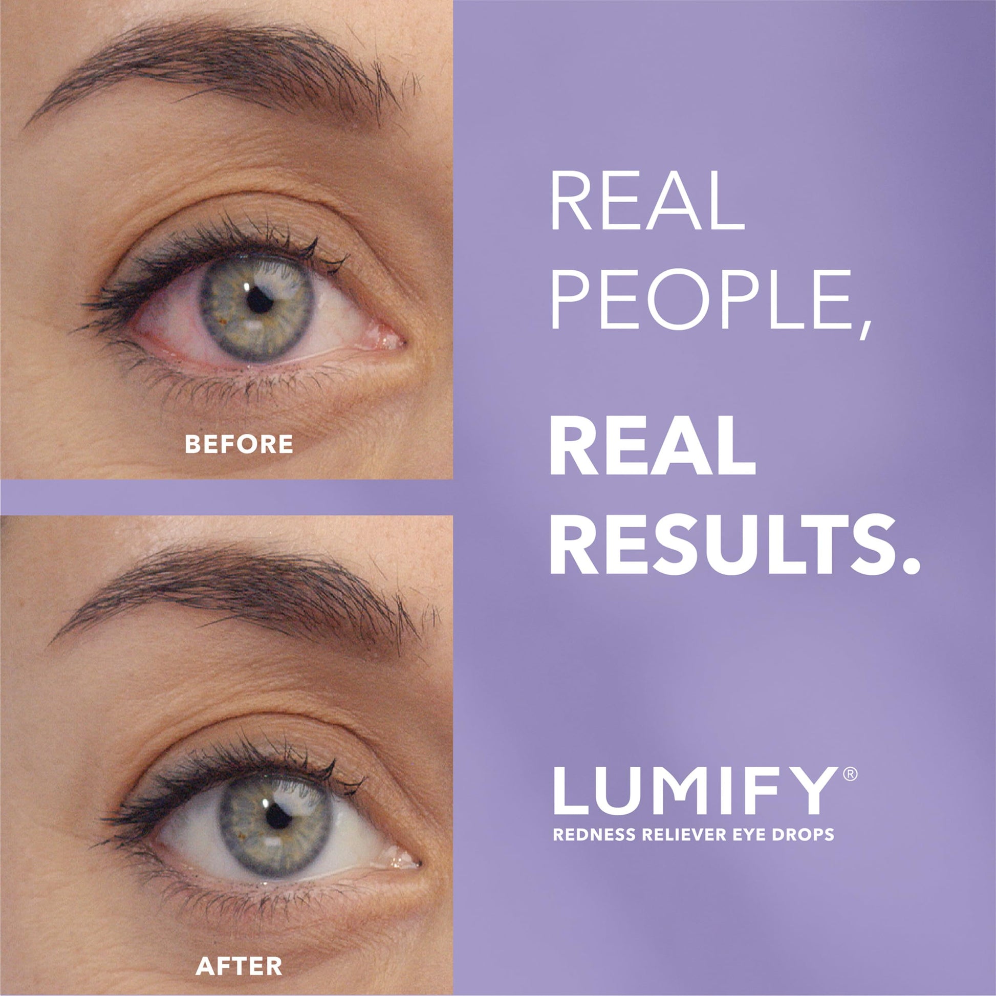 Buy now LUMIFY Eye Drops for Red Eyes, Redness Reliever for Brighter Looking Eyes, Works in 1 Minute & Lasts Up to 8 Hours, Eye Drops, 0.25 Fl Oz (7.5mL) at indiglob india
