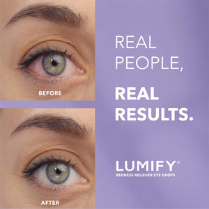 Buy now LUMIFY Eye Drops for Red Eyes, Redness Reliever for Brighter Looking Eyes, Works in 1 Minute & Lasts Up to 8 Hours, Eye Drops, 0.25 Fl Oz (7.5mL) at indiglob india